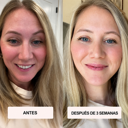 Máscara LED y Microcorriente para Lifting Facial sin Cirugía - Atlas Lab Nova™